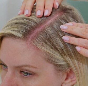 Suchá pokožka hlavy - hlavní příčiny a účinná řešení