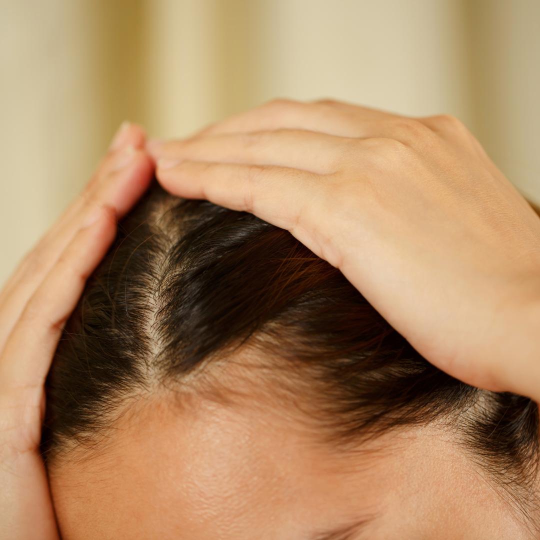 Vypadávání vlasů příčiny