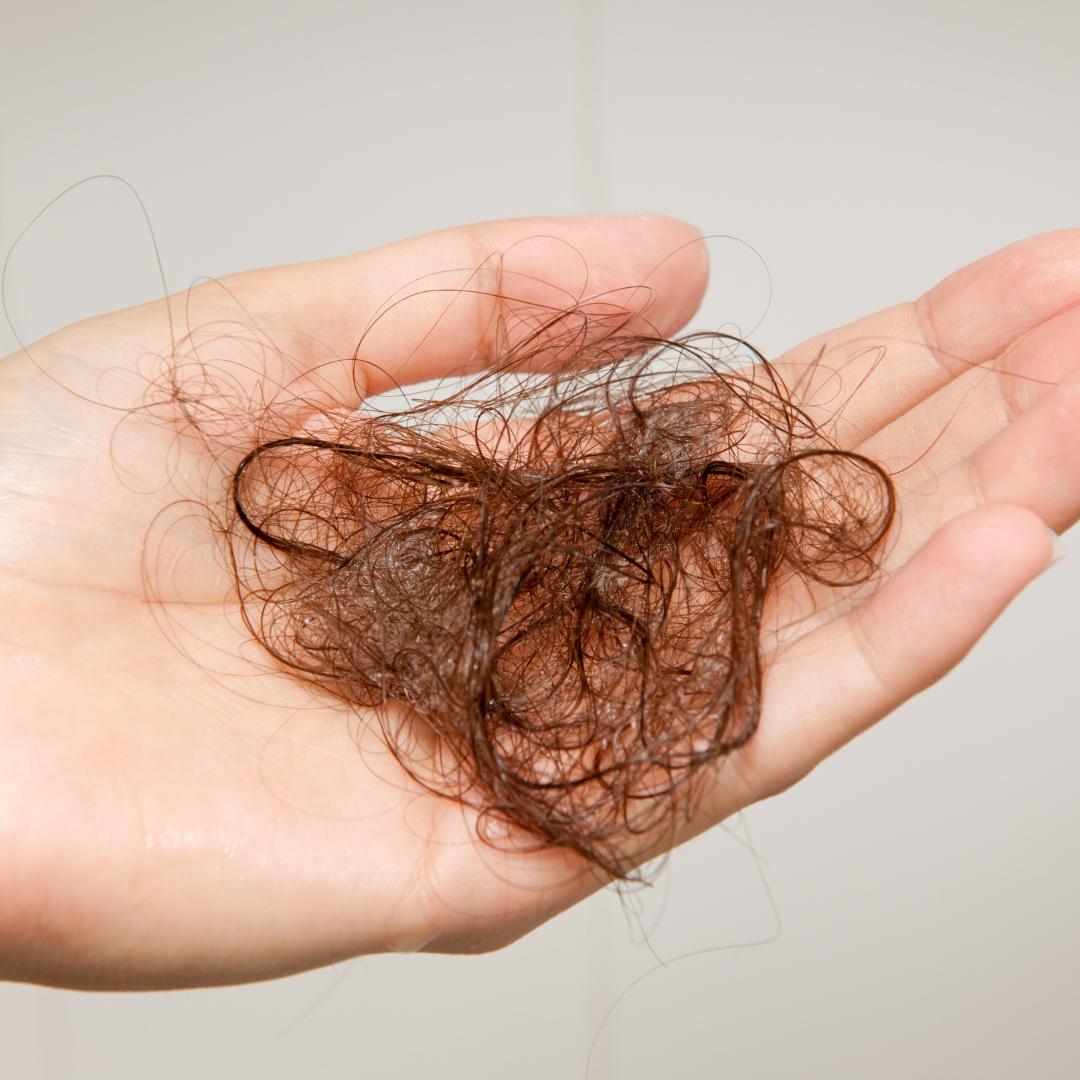 Vypadávání vlasů ženy